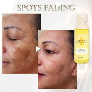 Oilex ™ natural spots brighten yellow peeling oil（Limited time discount 🔥 last day）