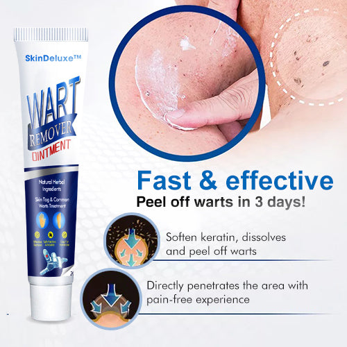 Skin Deluxe™ Wart Removal Ointment (🔥Limited Time Discount )